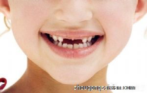 梦见自己牙齿掉了四颗是什么意思