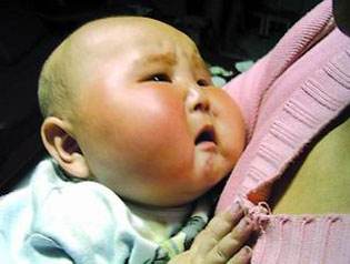 梦见非常难看的婴儿是什么意思