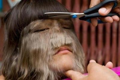 梦见脸上长毛是什么意思